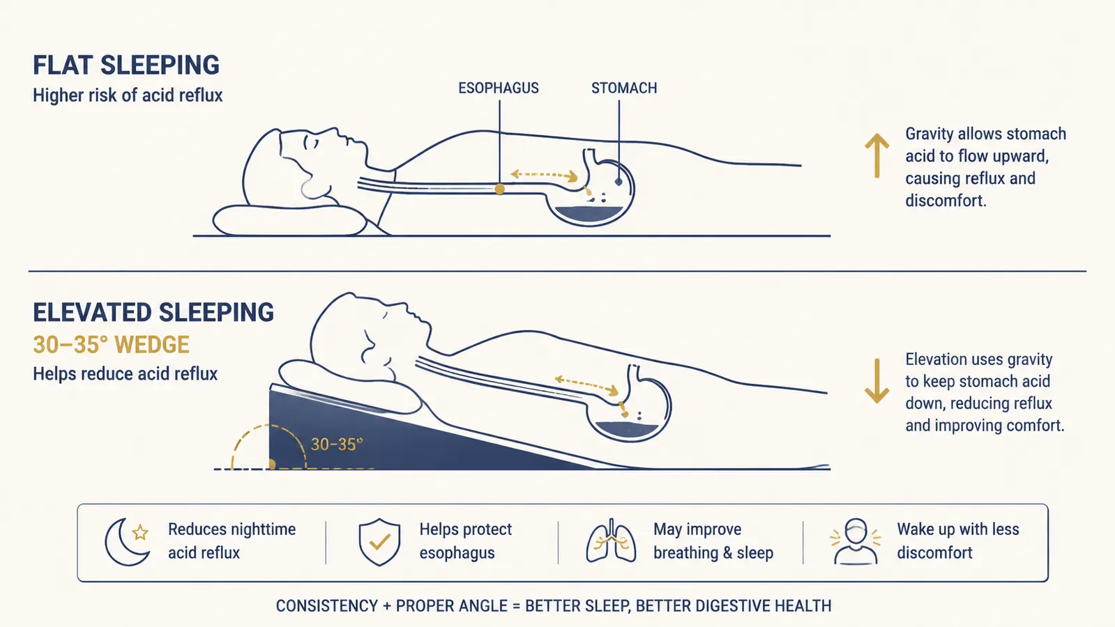 Diagram showing correct torso elevation angle for acid reflux versus flat sleeping